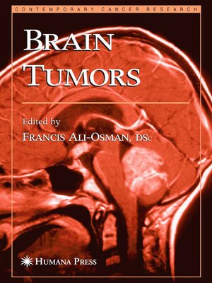 cover image of Brain Tumors